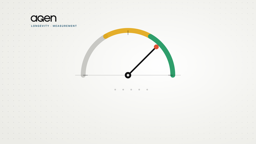 Agen figure: a strength gauge with the needle pointing into the strong zone.