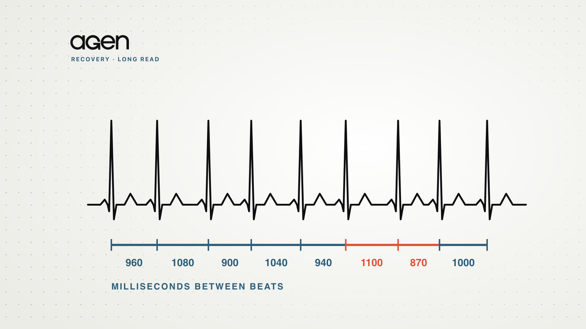 An ECG trace of nine heartbeats with the milliseconds between each beat labelled underneath, two intervals highlighted in coral